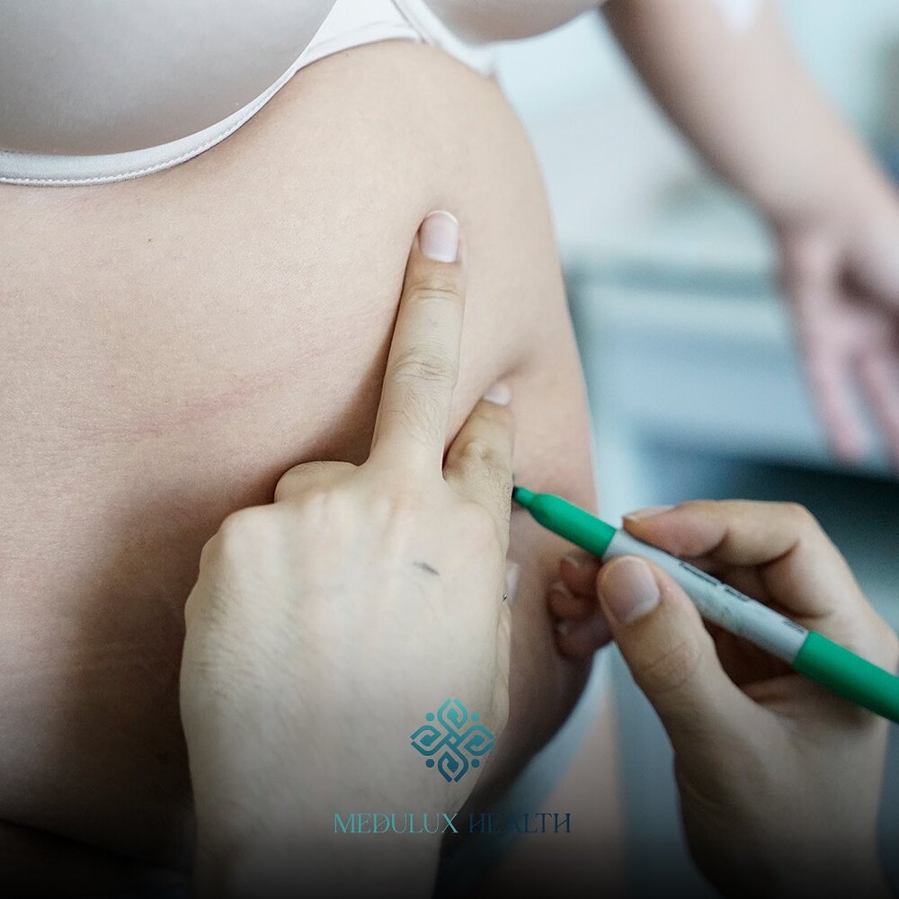 Before and After Result